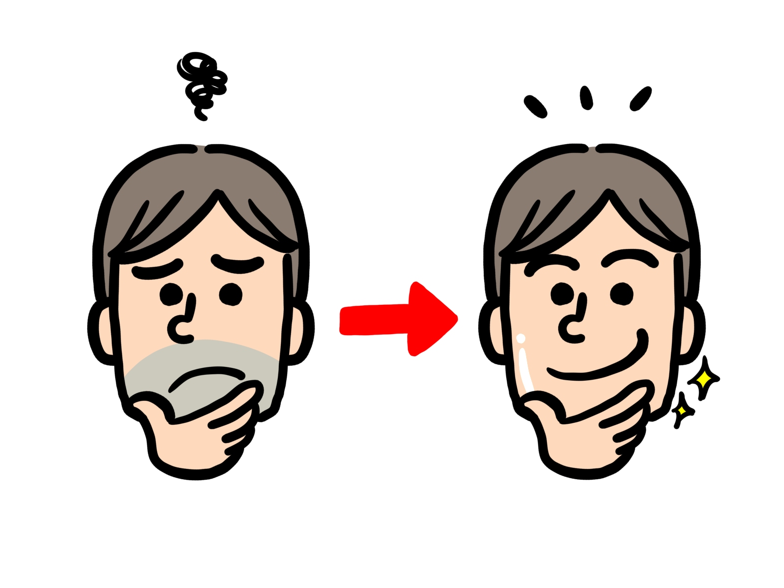医療ヒゲ脱毛とは？効果・流れ・注意点を解説